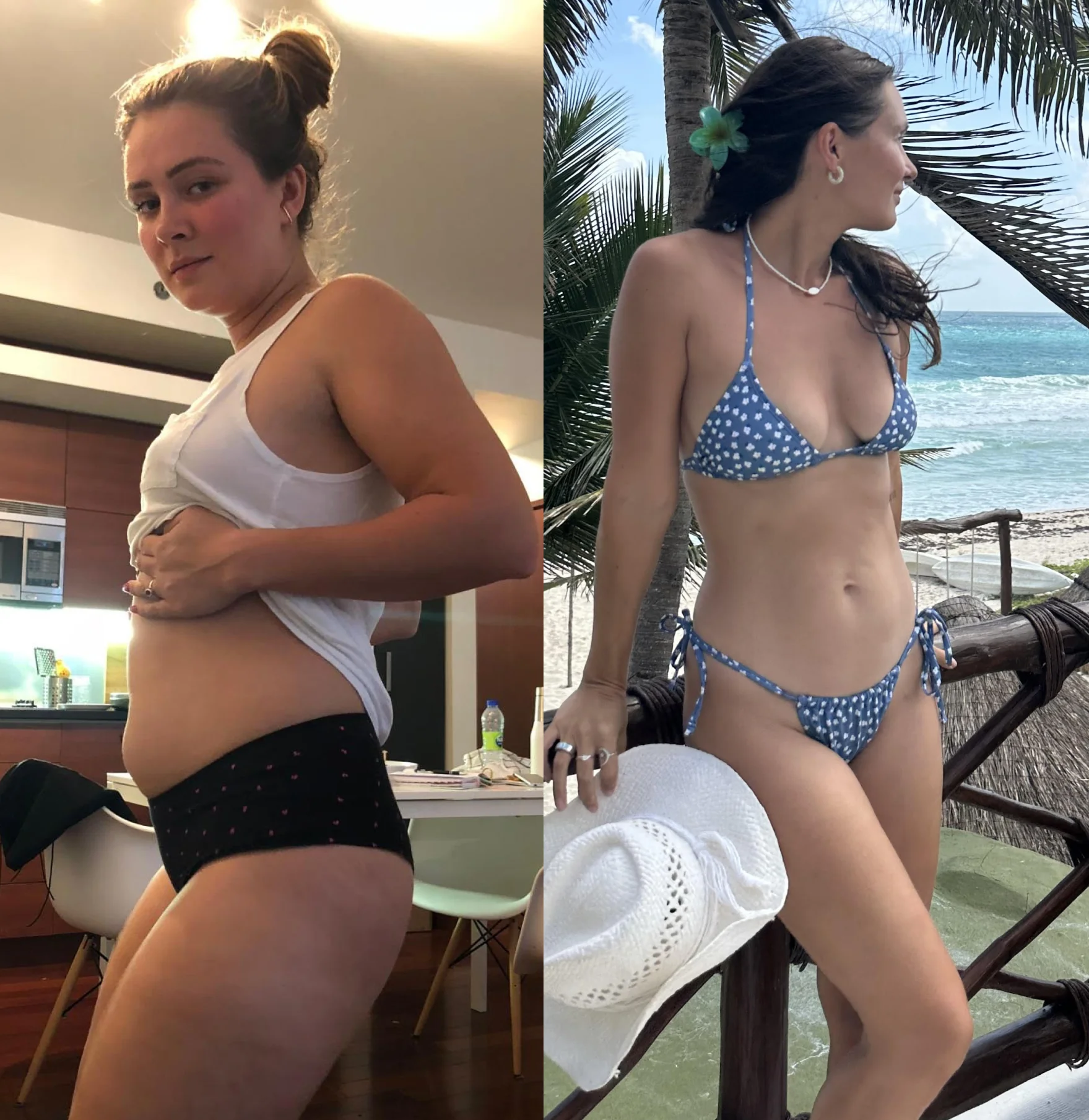 Zelata before and after: bloated belly, then a flat stomach on the beach